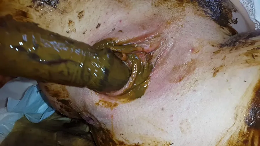 Anna Coprofield FullHD 1080p Gynecological Self-Examination Shit - Filled Pussy Thought The Speculum [Efro, Pee]