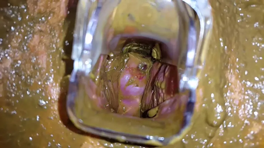 Anna Coprofield FullHD 1080p Tampon, Speculum Filled Pussy Part 2 [Shitting, Pooping Girls]