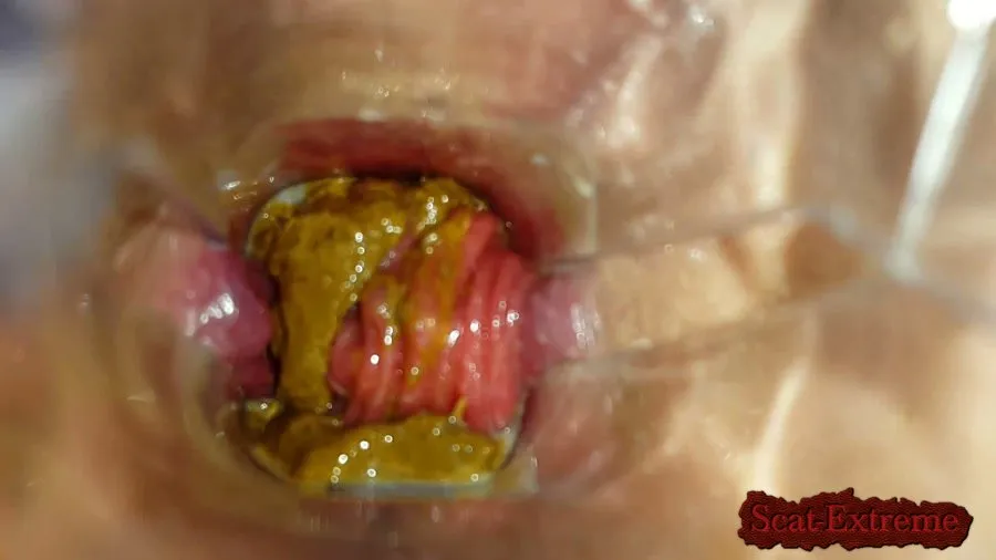 Anna Coprofield FullHD 1080p Speculum Play and Filled Pussy part 1 [Farting, Poop]