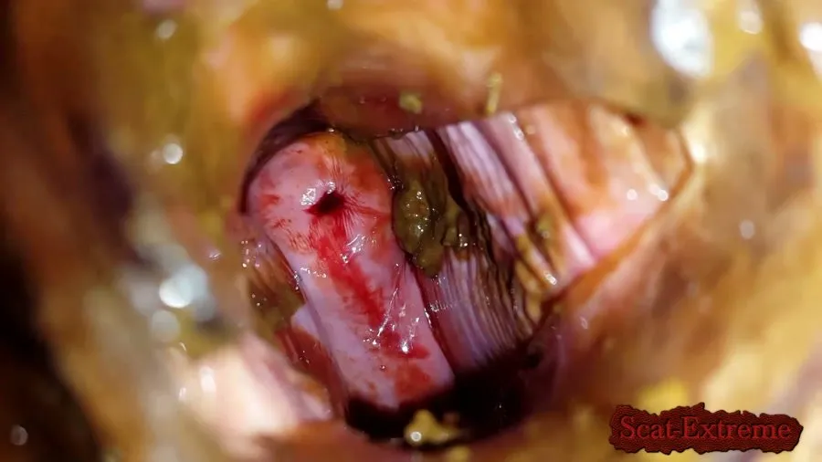 Anna Coprofield FullHD 1080p Shit and Blood Vol.5 Speculum Full version [Slander, Smear]