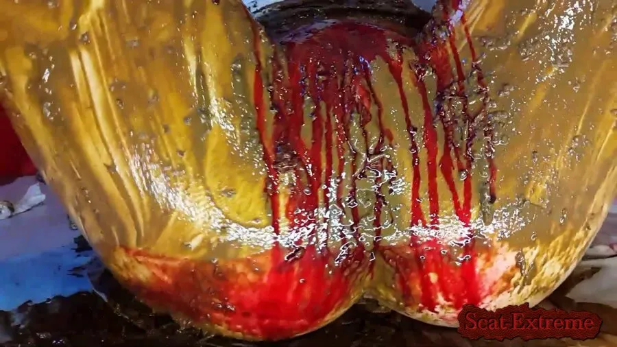 Anna Coprofield FullHD 1080p Shit and Blood Vol.5 Speculum Part 2 [Poop, Defecation]