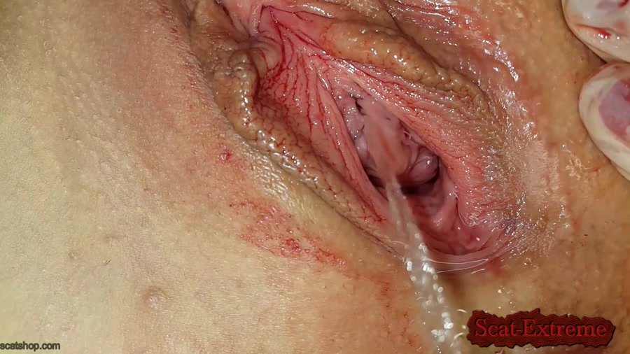 Anna Coprofield FullHD 1080p Shit and Blood Vol.8 Speculum [Solo, Defecation, Extreme Scat, Scatology]
