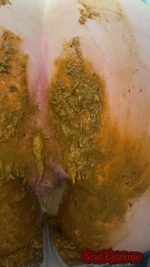 Sexandcandy18 UltraHD 2K Extreme jean accident [Scatology, Jeans]