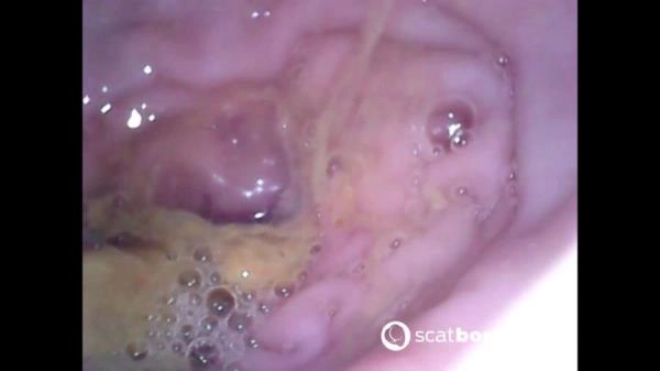 Show Inside Of My Ass With Endoscope [FullHD 1080p / 378 MB] Scatbook.com