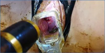 Anna Coprofield brutal Speculum Play and Farting During Menstruation