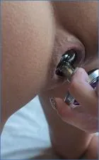 Pulling Plug Out Slowly with Brutal Anal Fisting and Extreme Kaviar by LilbuttLex