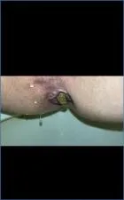 Missellie in Extreme Coprophilia: Comparing Farts and Poop