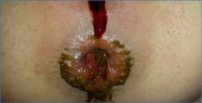 Anna Coprofield Pushes Limits in Extreme Morning Scat porn