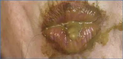 Dirtygardengirl's Extreme Scat Vomit Show with Enema and Stockings