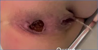 Alice Hatter Defecates Kaviar and Takes Extreme Anal with Big Toys