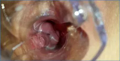 Anna Coprofield - Extreme Toilet Action with Prolapse and Masturbation
