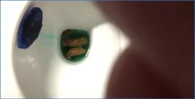Ella Gilbert Shows Off Her Massive Bowel Movement and Fisting Skills